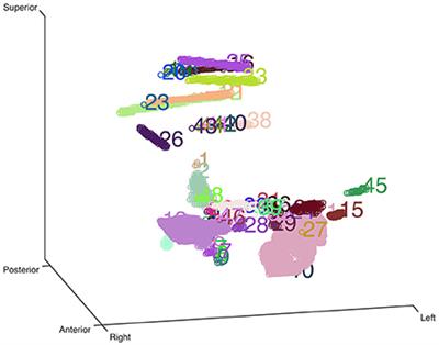 Automatic and Precise Localization and Cortical Labeling of Subdural and Depth Intracranial Electrodes